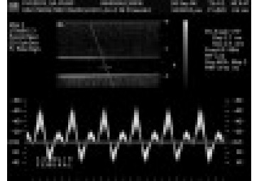 BMF-����(gu��)