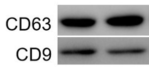 8 外泌體標(biāo)志物鑒定 外泌體Western blot鑒定服務(wù).png